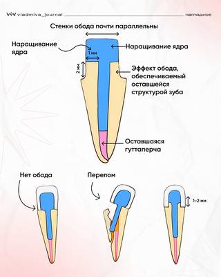 Эффект обода: ключ к долговечной реставрации.